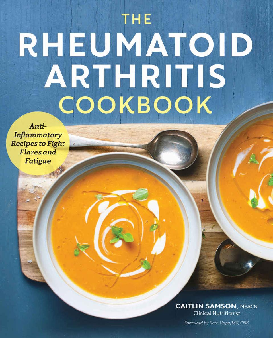 Rheumatoid Arthritis